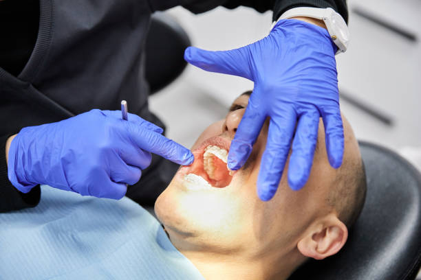 Best Emergency Broken Tooth Repair in La Conner, WA